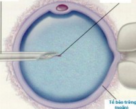 Phụ Lục 5: Thụ Tinh Nhân Tạo